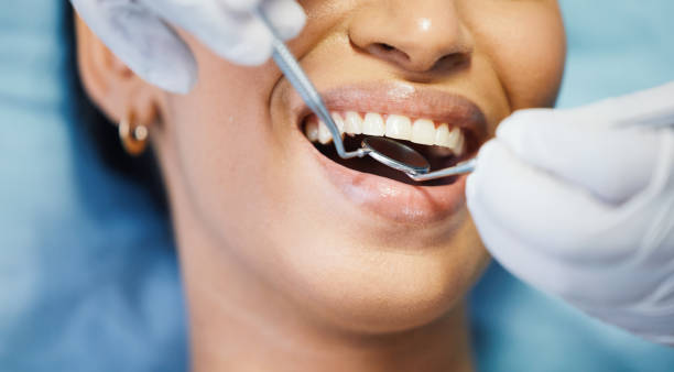 Best Broken or Cracked Tooth Emergency Dentist in Henderson, KY